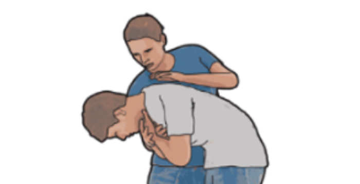 Cách thực hiện động tác ép bụng (cơ động Heimlich) lên người khác